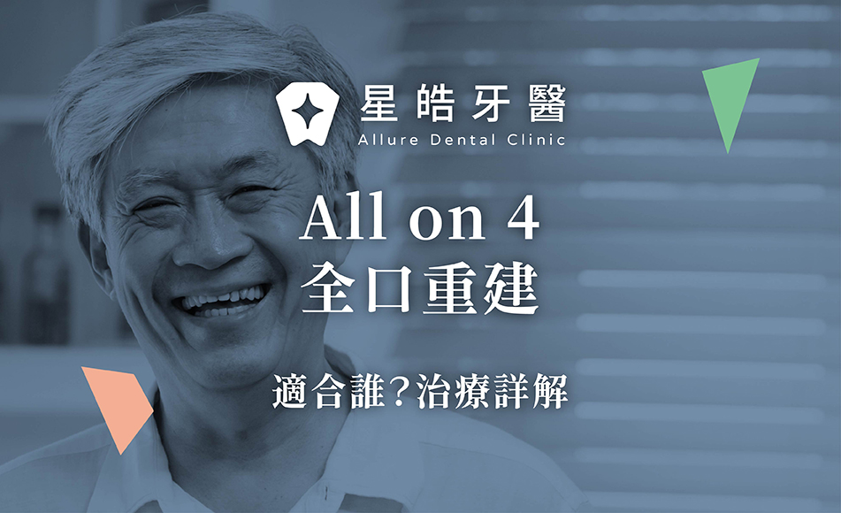 封面圖 All on 4全口重建：適合誰？治療詳解