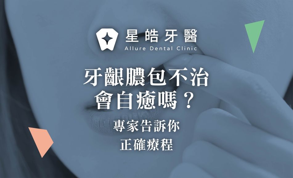 封面圖 牙齦膿包不治會自癒嗎？專家告訴你正確療程